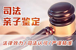 嘉兴司法DNA鉴定的流程(办理地址)，嘉兴司法DNA亲子鉴定哪里做